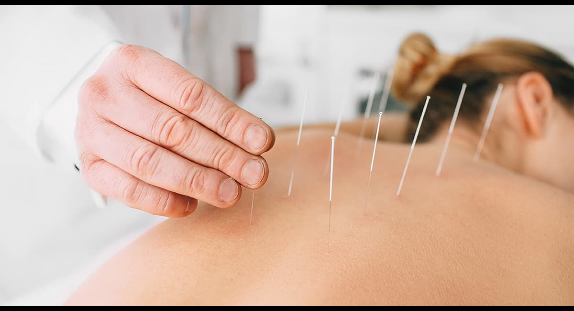 What Insurance Do Victoria Acupuncturists Need